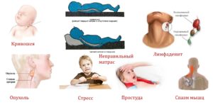 Причины боли в шее у ребенка