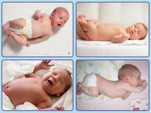 Гипертонус у новорожденного симптомы