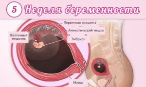 Признаки беременности срок 5 недель