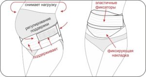 Универсальный послеродовой бандаж как одевать