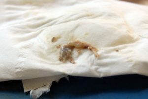 Третья неделя беременности мажущие выделения