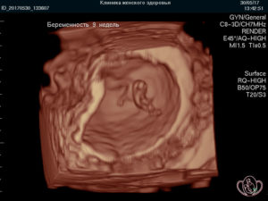 Скрининг 9 неделе беременности
