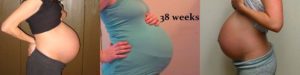 Потливость 38 неделе беременности