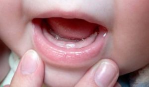 Во сколько режутся первые зубы у детей