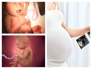 Головокружение тошнота 33 неделе беременности