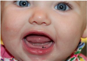Во сколько начинают резаться зубки у ребенка