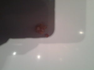 4 Недели беременности капля крови