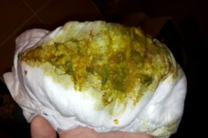 Ребенок покакал зеленым калом