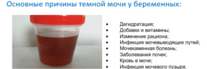 Темная моча 38 неделе беременности
