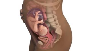 Запор 18 неделе беременности