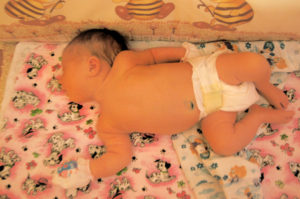 Ребенок плачет и выгибается назад