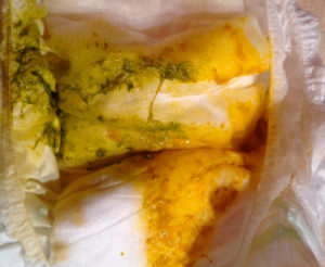 У новорожденного зеленые стул