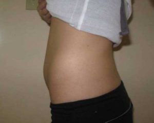 Растет живот 8 неделе беременности