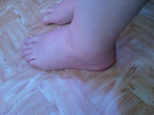 Отекают ноги на 29 неделе беременности