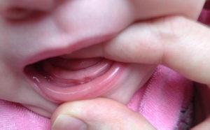Во сколько месяцев первые зубки лезут