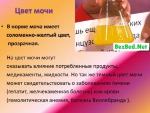 Цвет мочи ребенка в норме