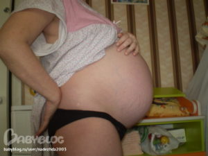 Тонус матки на 30 неделе беременности