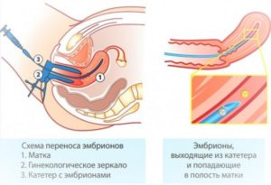 8 Неделя после переноса эмбрионов