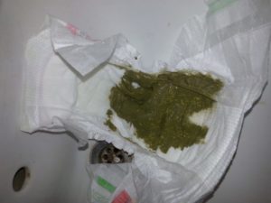 У новорожденного зеленые стул