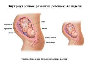 32 Неделя беременности расположение плода