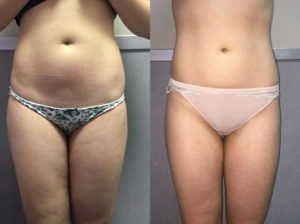 Коррекционный массаж отзывы