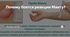 После манту правила для родителей