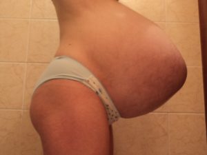 Каменеет живот на 28 неделе беременности