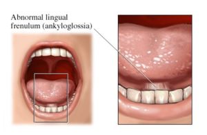 Что делать если р?