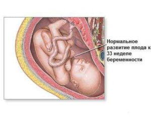 33 Недель частое мочеиспускание беременность