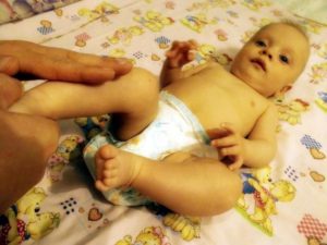 Гипертонус мышц у ребенка в 6 месяцев