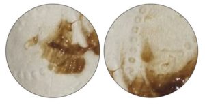 Сгустки темно коричневые на 8 неделе беременности
