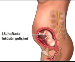 Где находится плод на 18 неделе беременности