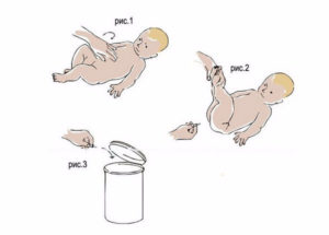 Трубка газоотводная для новорожденных инструкция по применению