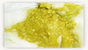 У новорожденного зеленые стул