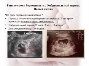 Определить эмбриональный срок беременности
