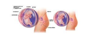 Ощущения женщины на 12 неделе беременности