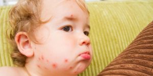 Ветрянка у восьмимесячного ребенка