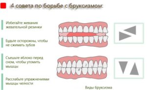 Во сне ребенок скрипит зубами что это