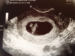 8 Недель узи 6