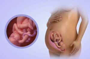 Однократное обвитие пуповиной на 33 неделе беременности