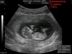 Начало 12 недели беременности ощущения
