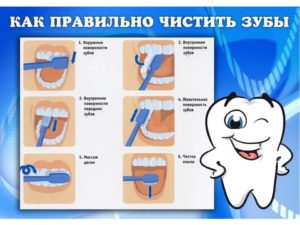 Как чистить ребенку зубы в год?