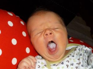 Налет на языке у новорожденного от молока