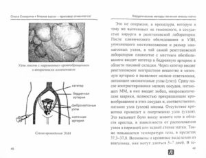 Миома матки 11 недель что делать