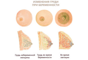 5 Недели беременности грудь сдулась