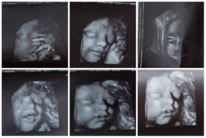 24 Неделя беременности плохо чувствую шевеления