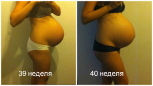 Твердеет живот на 36 неделе беременности