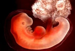 3 5 4 Недели беременности