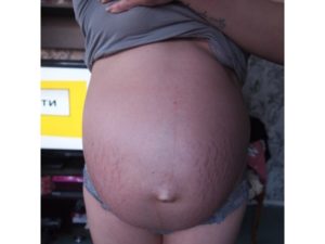 29 Неделя беременности тянет низ живота