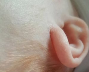 За ушами у новорожденного